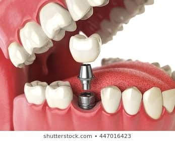 Best Dental care in Satellite