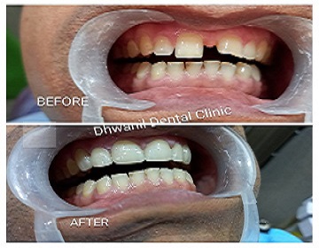 Dhwanil Dental Clinic In Ahmedabad