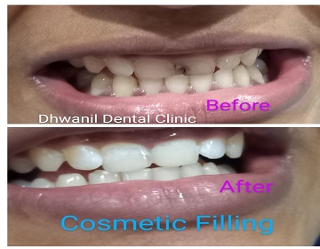 Dhwanil Dental Clinic In Ahmedabad