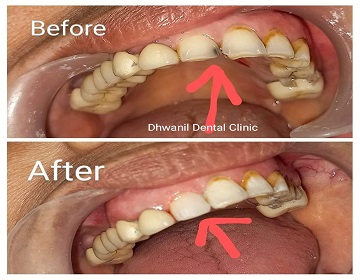 Dhwanil Dental Clinic In Ahmedabad