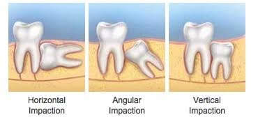 Periodontal Surgery in Ahmedabad