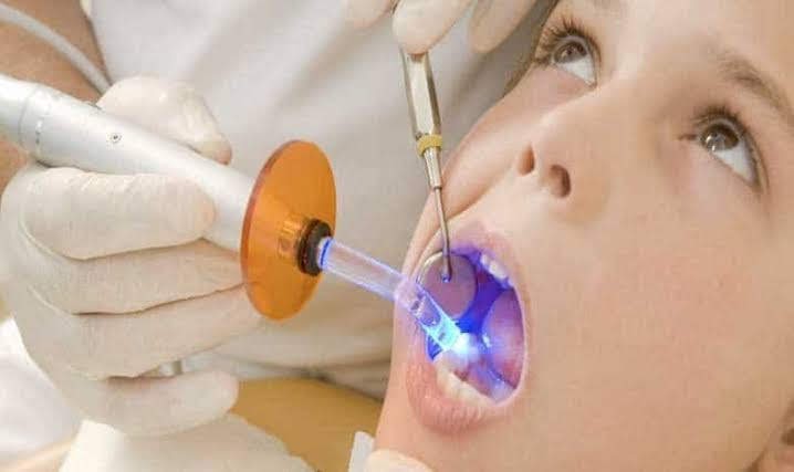 Teeth Whitening in Ahmedabad