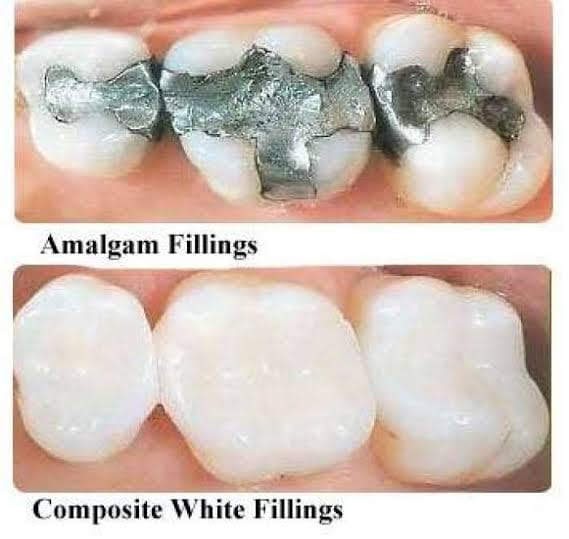 Periodontal Surgery in Ahmedabad