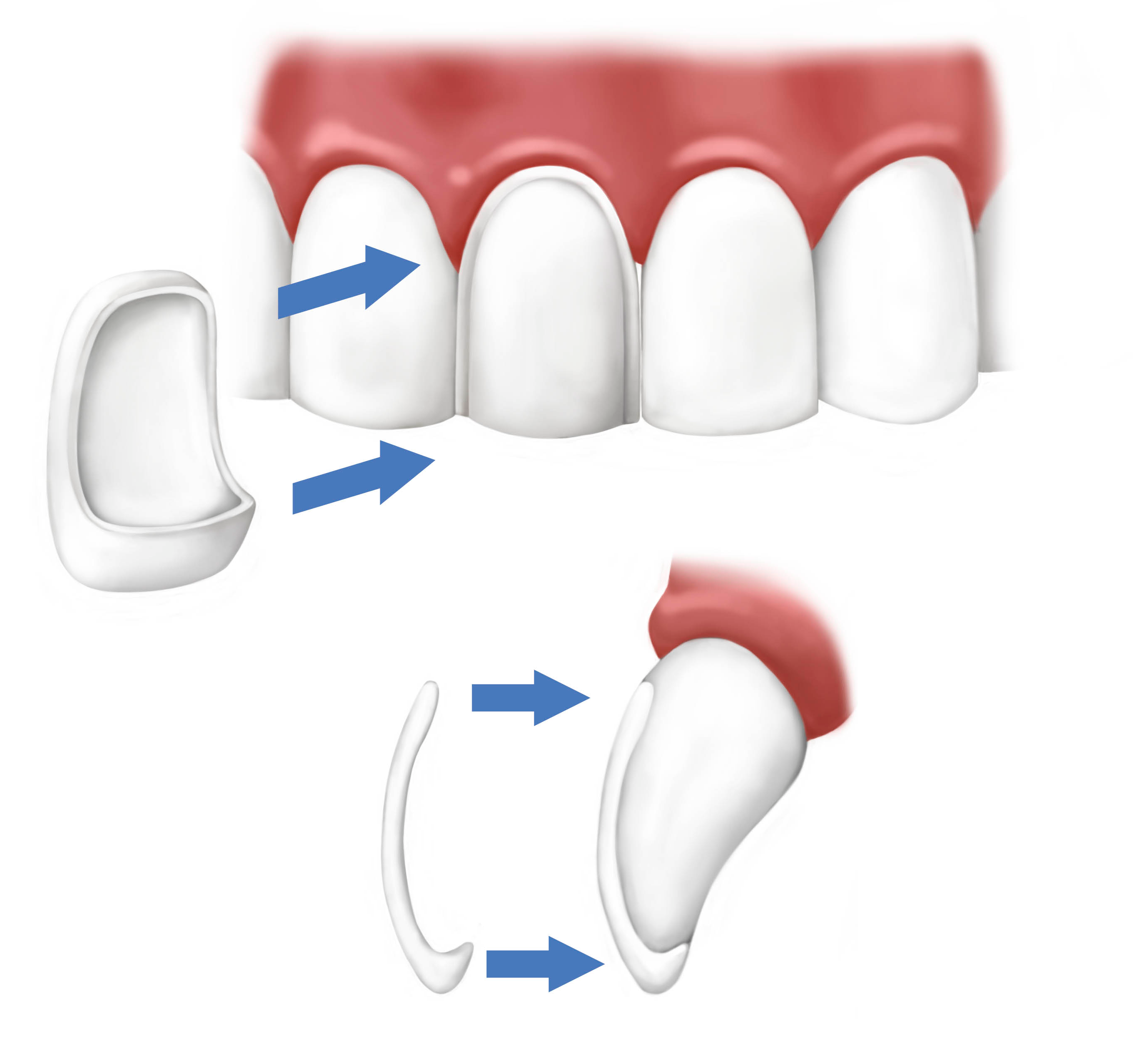 Smile Design in Ahmedabad