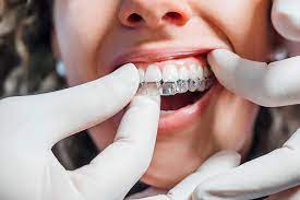 Best Dental Clinic in Satellite